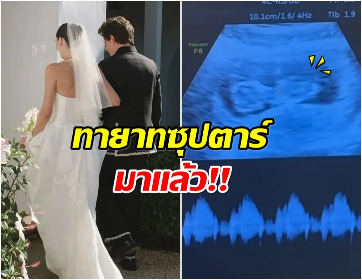 ชาร์ลี พุท (Charlie Puth) ศิลปินหนุ่มเจ้าของเพลง “Changes” เผยข่าวดี